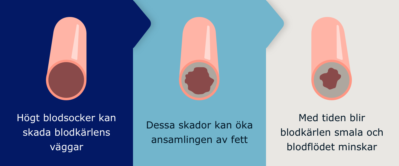 Infographic displaying the damage of sugar on blood vessels.